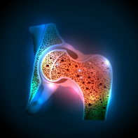 Mental Health Linked to Bone Health