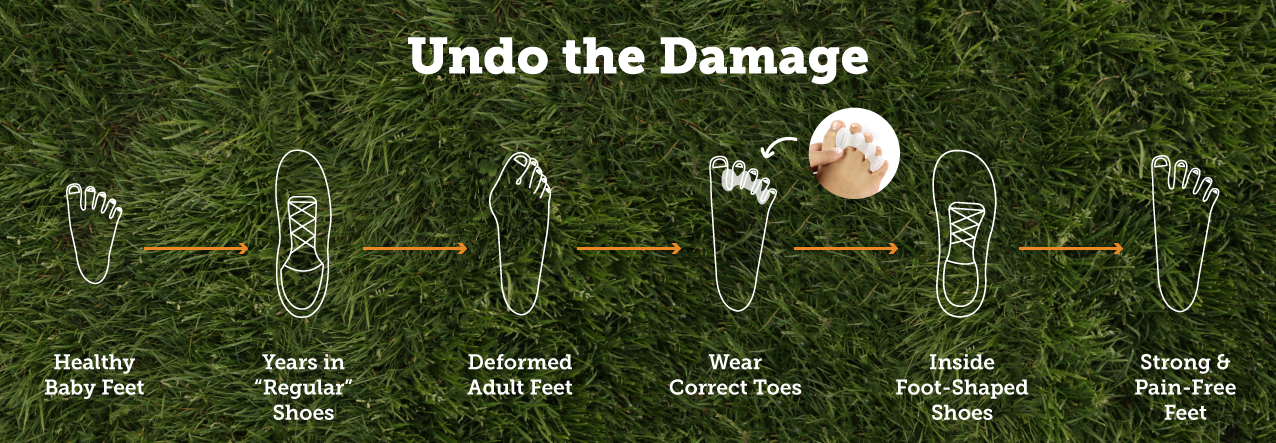Correct Toes Chronology.png