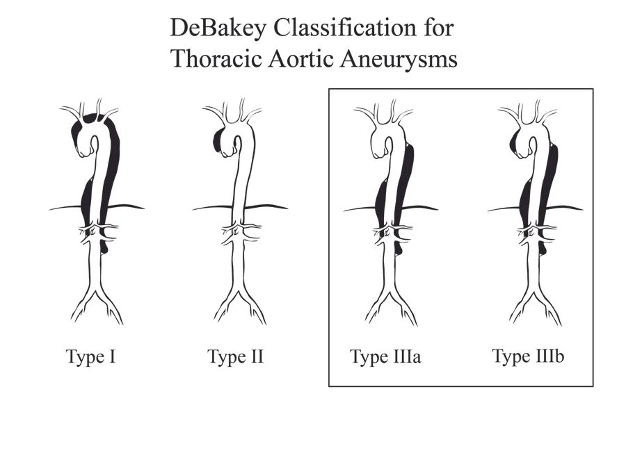DeBakey.6.8.11-01.jpg