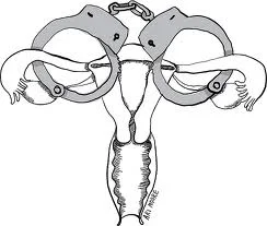 Forced Sterilization: A Global Travesty