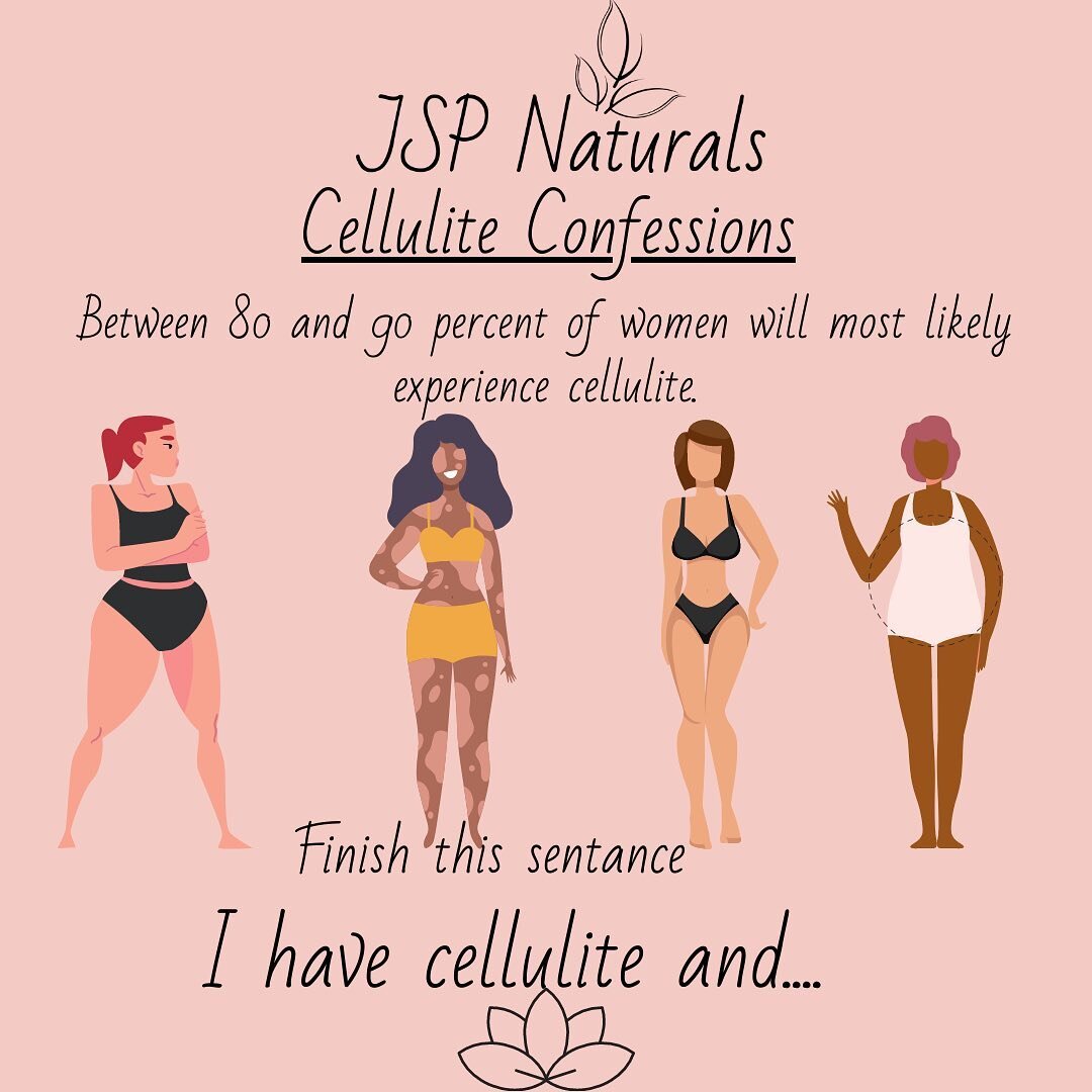 Finish this sentence for me: &ldquo;I have cellulite AND&hellip;&rdquo; I&rsquo;ll go first- I have cellulite and it doesn&rsquo;t stop me from wearing whatever I like best! No matter your weight or size most people will have some cellulite some wher