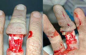 Episode 17: Gerry Fitzgerald Show Notes