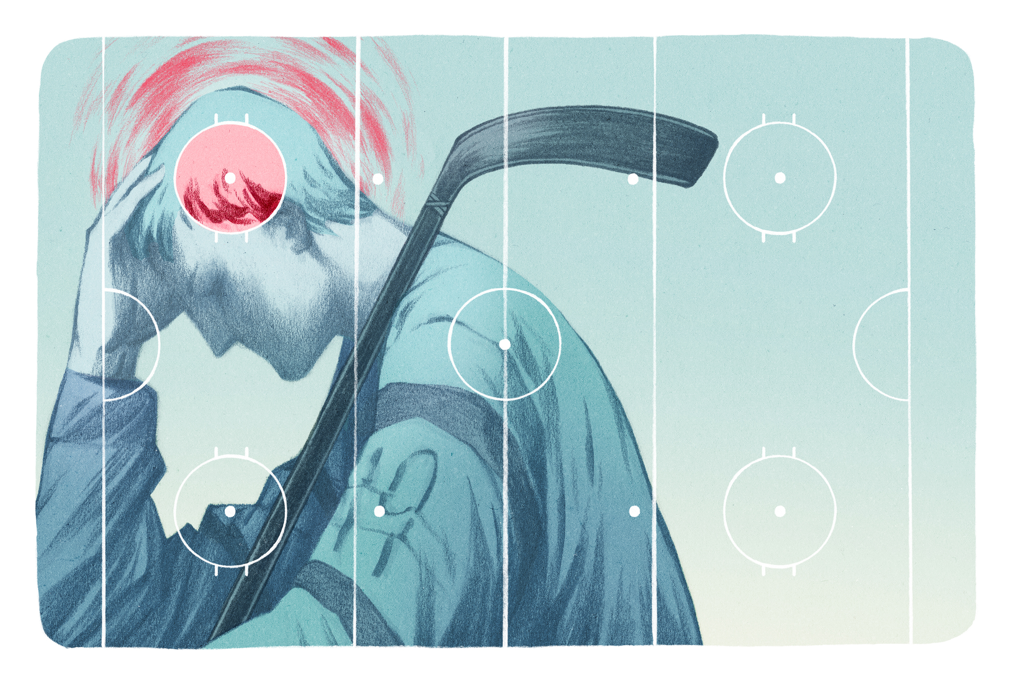 Concussed