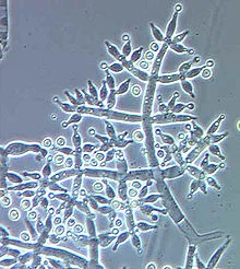 Trichoderma_harzianum.jpg