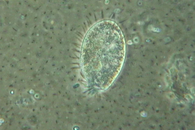 Figure 1: Close up view of a ciliate (protozoa) with various bacteria in the background. Photographed by Tim Wilson. Ohio State Univeristy