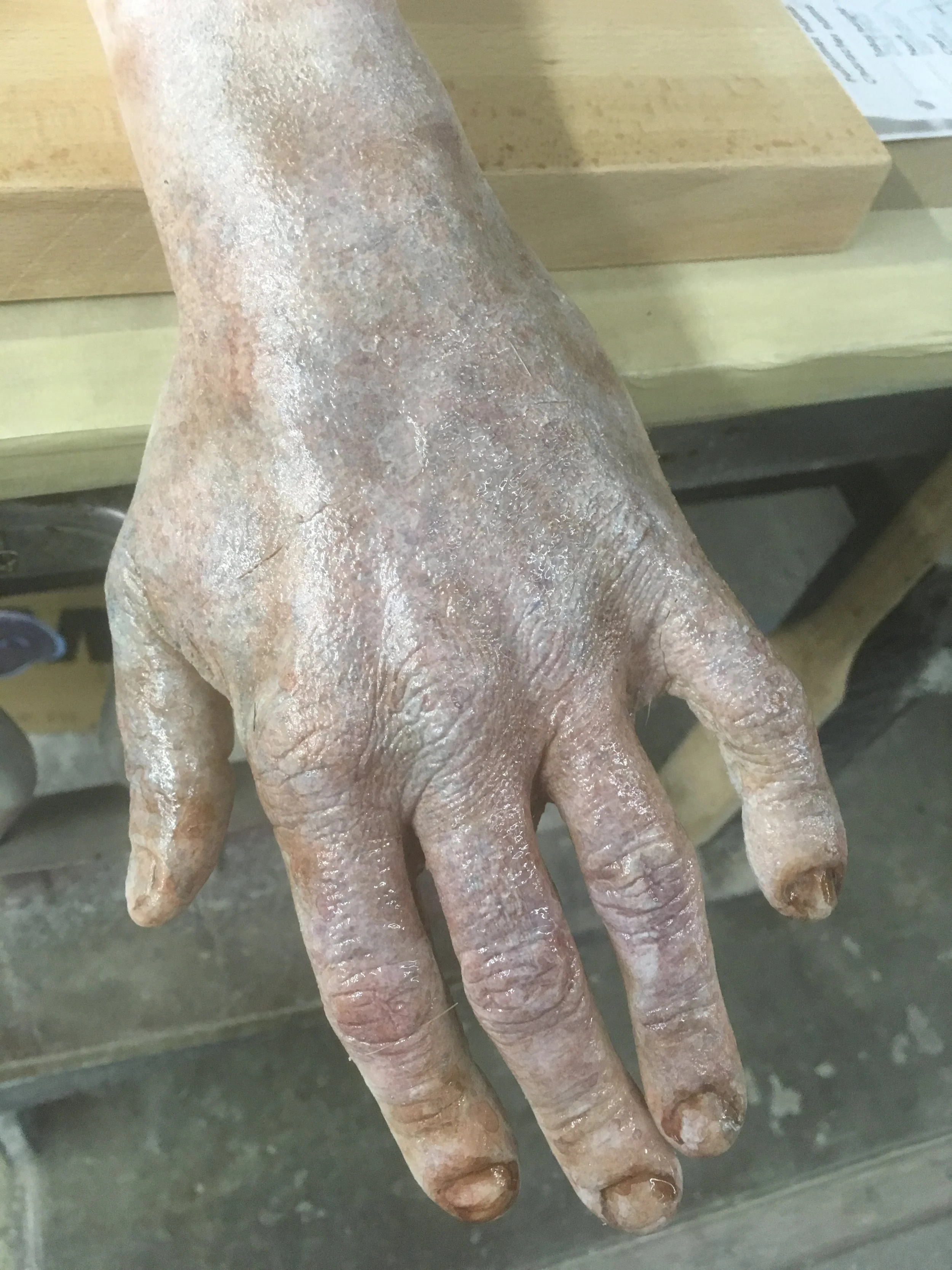  Silicone, dead hand. 