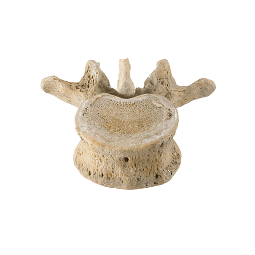 lumbar_sample.gif