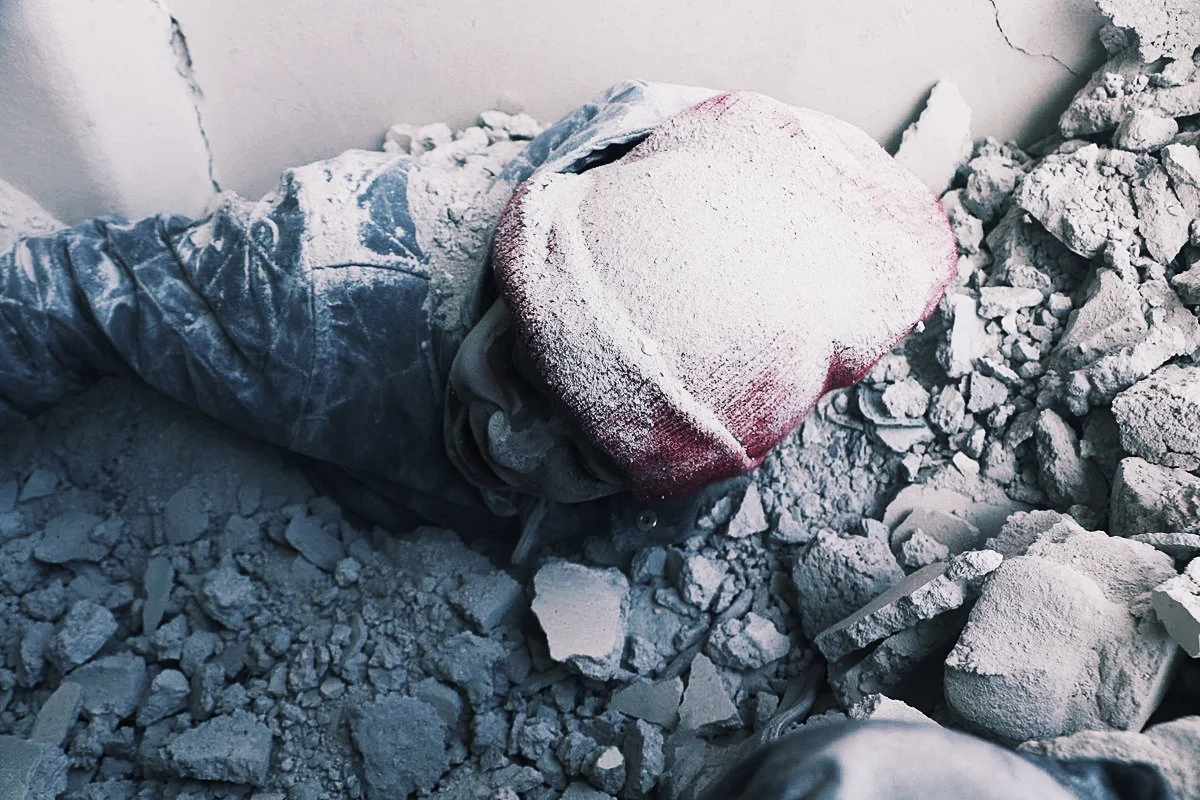 An injured child following reported bombardment by Syrian and Russian forces in the rebel-held Eastern Ghouta, on January 6, 2018. (via @SiegeWatch )