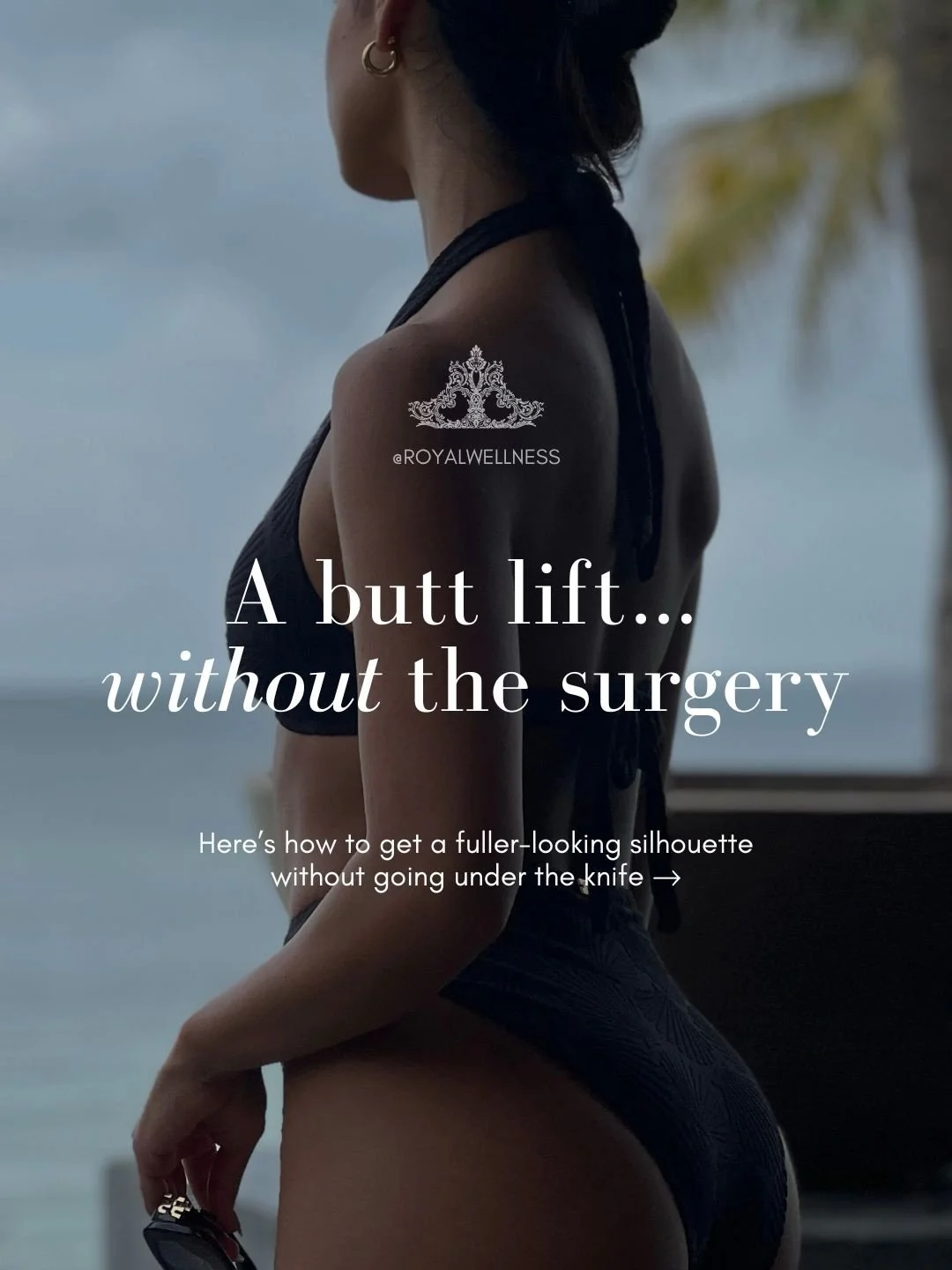 Wanna add a little extra oomph to your physique for Summertime? Radiesse might be your perfect solution. This isn&rsquo;t about extremes.. it&rsquo;s about refinement and balance. 

It&rsquo;s the perfect treatment for clients who want noticeable enh
