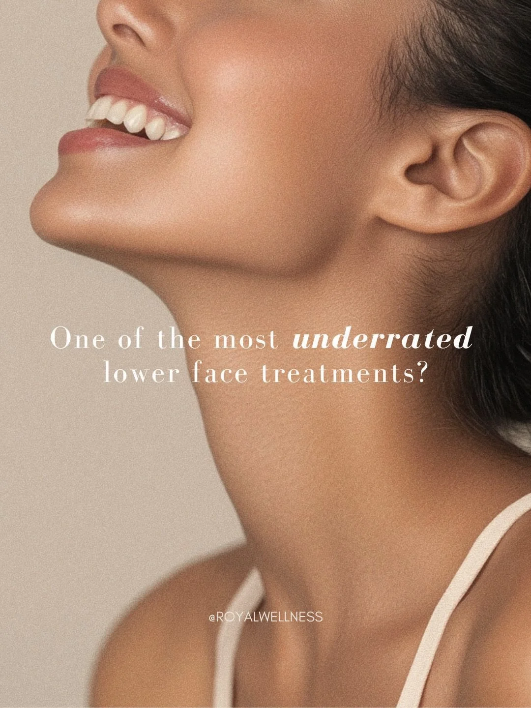 One of my favorite lower face treatments and for good reason! Subtle but noticeable✨

Nefertiti Lift results? 
- More snatched and defined jawline 
- Less early jowling
- A smoother, longer looking neck 
- No downtime 
 
Consultations are available ?