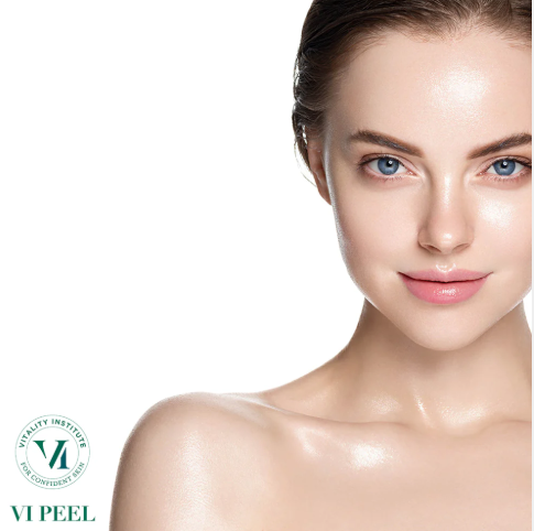 VIPeel.png