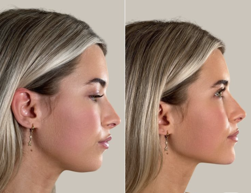 Screenshot 2025-11-26 at 8.11.20 PM.png