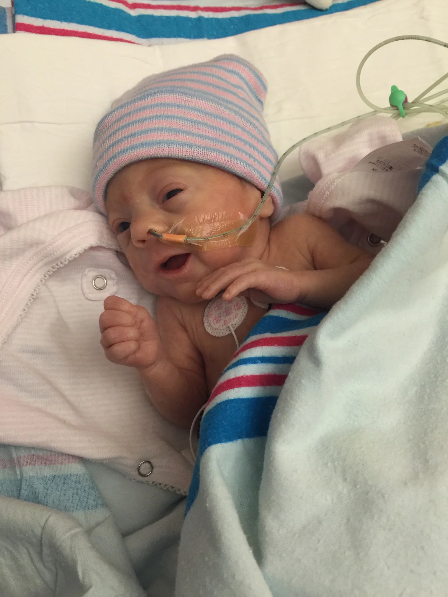 Audrey, happy to be free and clear of the velcro and nose prongs of CPAP