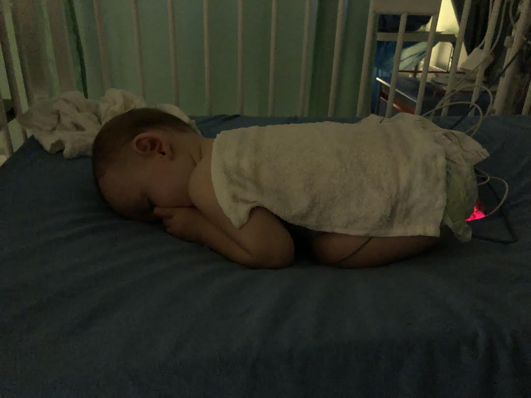 This was around 3am when we placed frozen wash cloths on his body, one right after another as he turned them hot within minutes from his body temperature being so high.