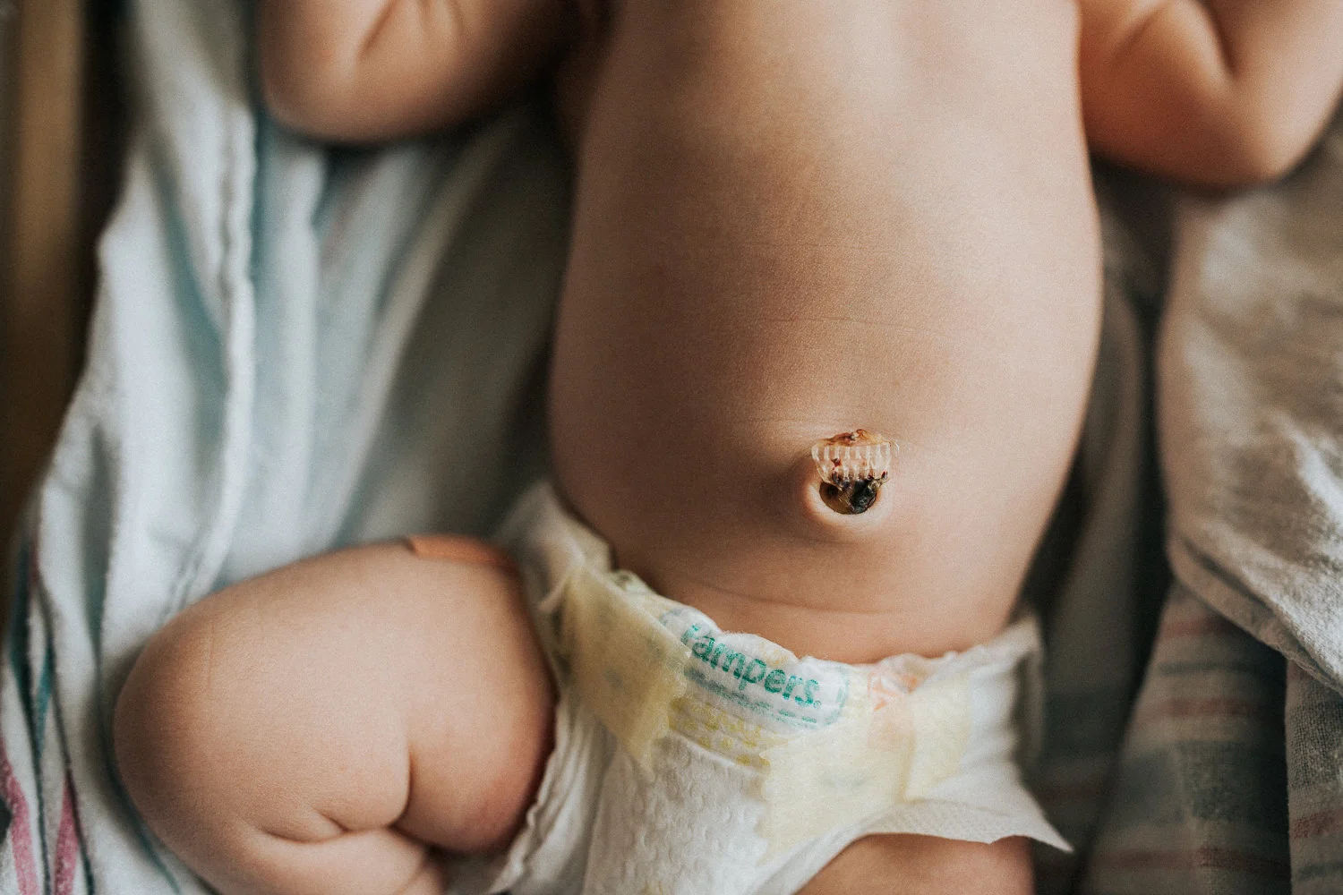 1 day old baby girl lying in diaper in hospital bassinet, close up of belly button - Newmarket Fresh 48 Photography