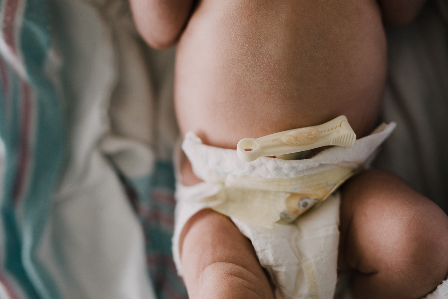 10 hour old baby boy in diaper lying in hospital bassinet, close up of bellybutton - Stouffville In-Hospital Photography