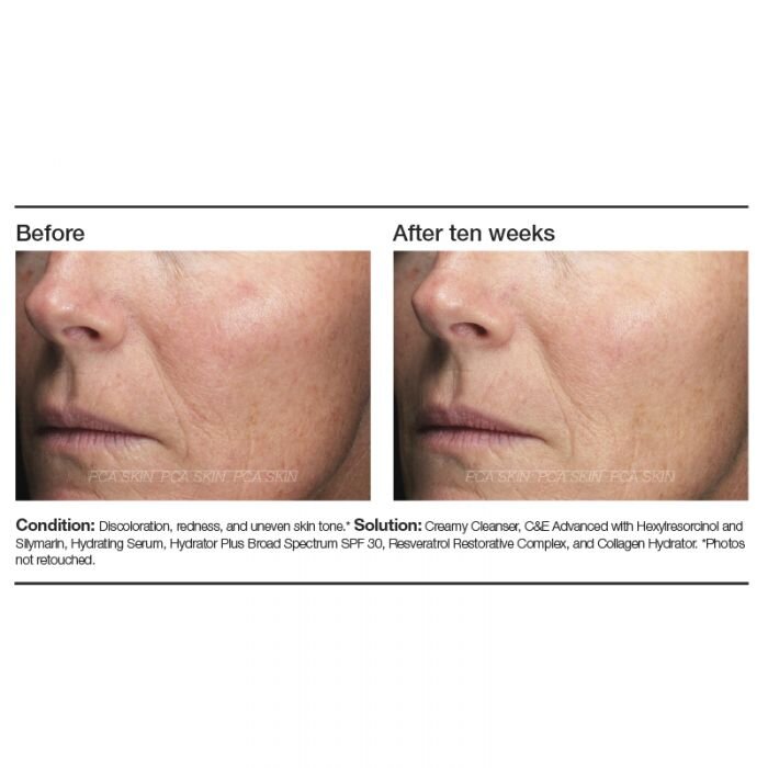 Resveratrol Restorative Complex