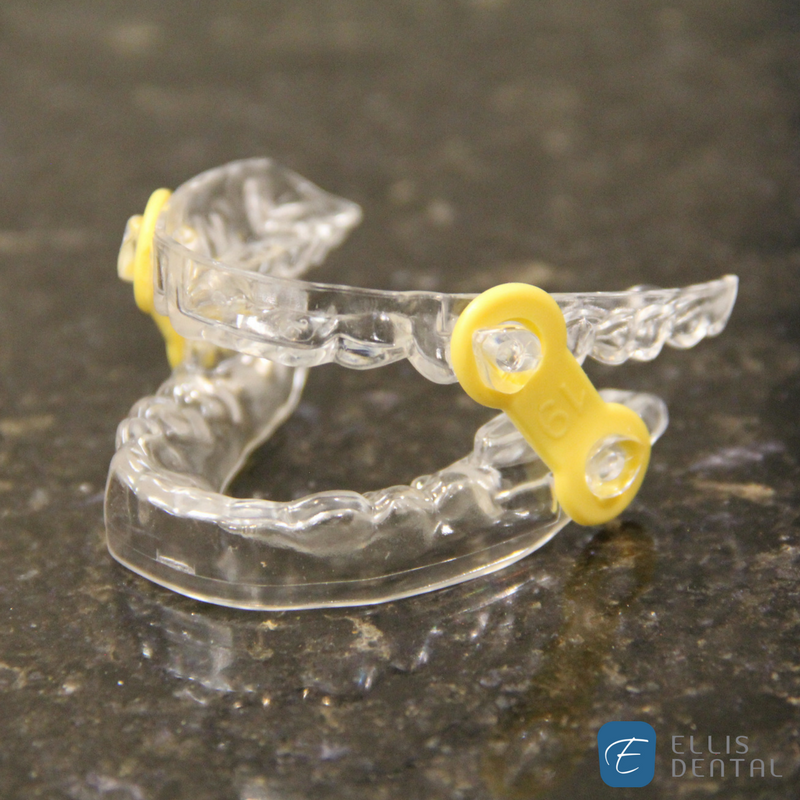 Ellis Dental Oral Sleep Appliance 
