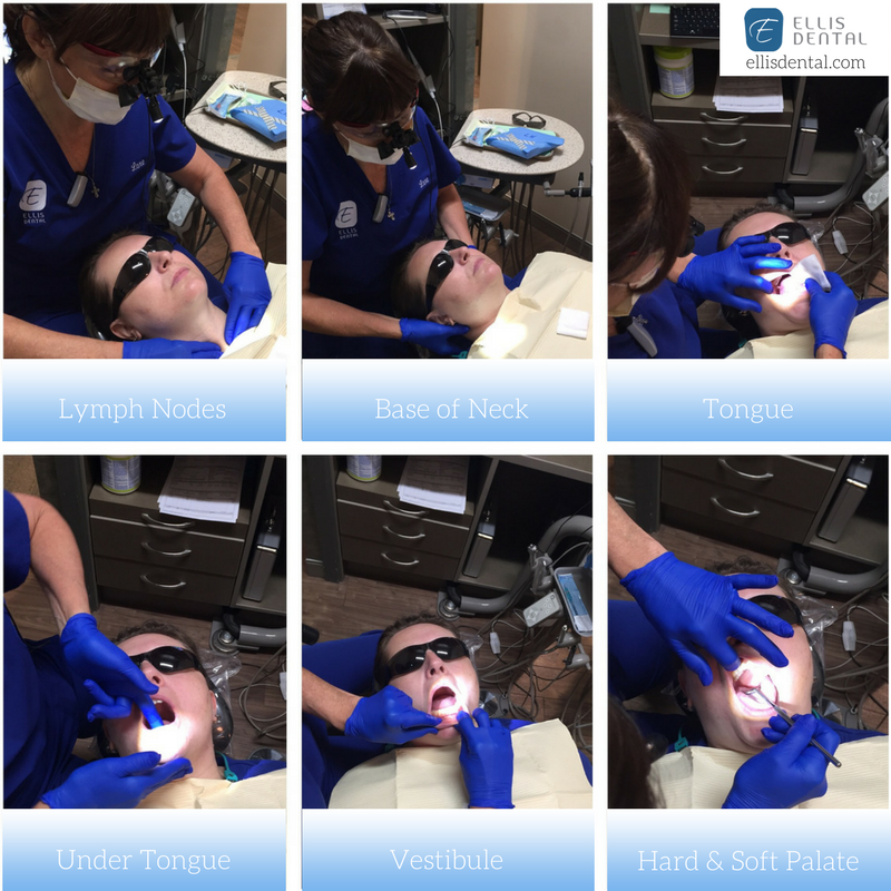 Ellis Dental Oral Cancer Screening