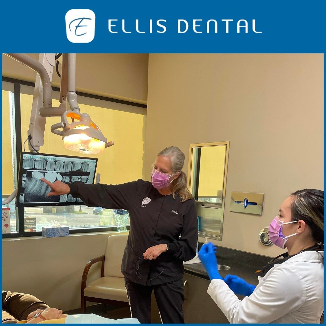 Here, Denise is pointing to the patient&rsquo;s molar. We worked with this patient to provide a crown and root canal treatment and we&rsquo;re showing them the improvements.