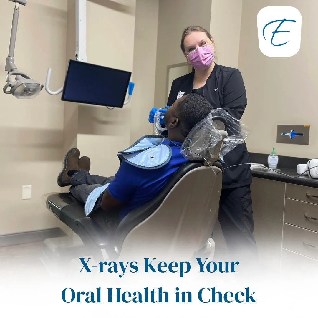 The most common type of X-rays we take are what&rsquo;s called bitewings. When we put that small piece of bendy plastic in your mouth and ask you to bite down. X-rays help us spot hidden oral health issues such as decay between teeth, infections in t