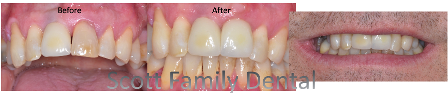Dental Specialists In Thunder Bay Scott Family Dental