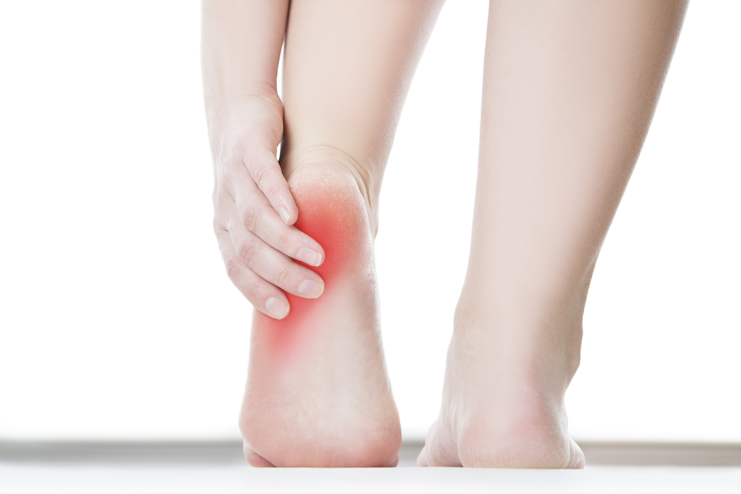 Heel Spur & Plantar Fasciitis: Causes, Symptoms, Treatments | CMM – Your  Foot Doctor
