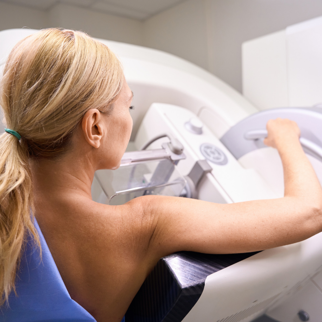 What Actually Happens When You Have a Mammogram?