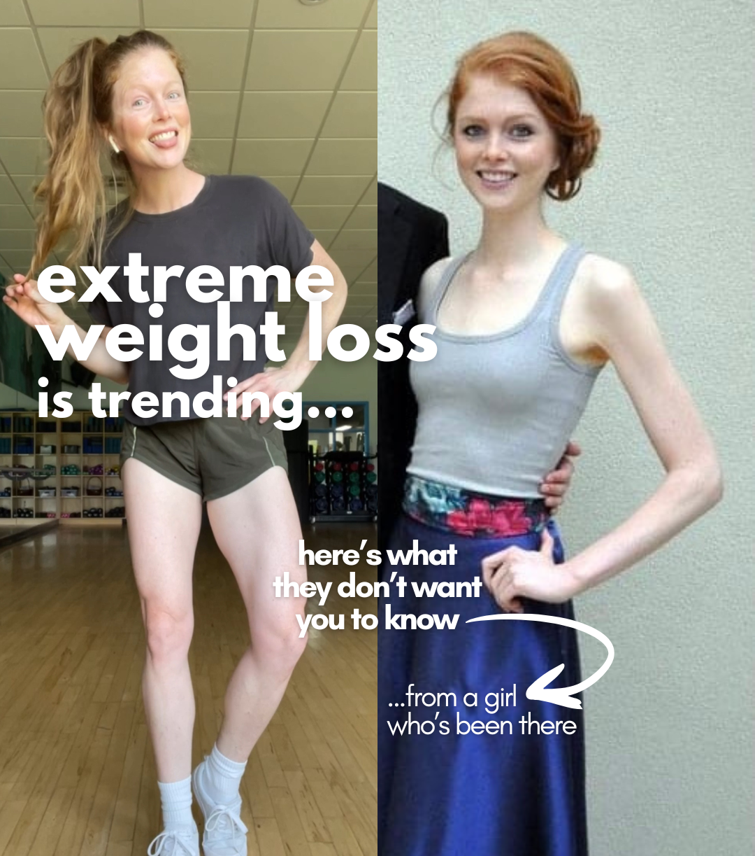 extreme weight loss is trending…