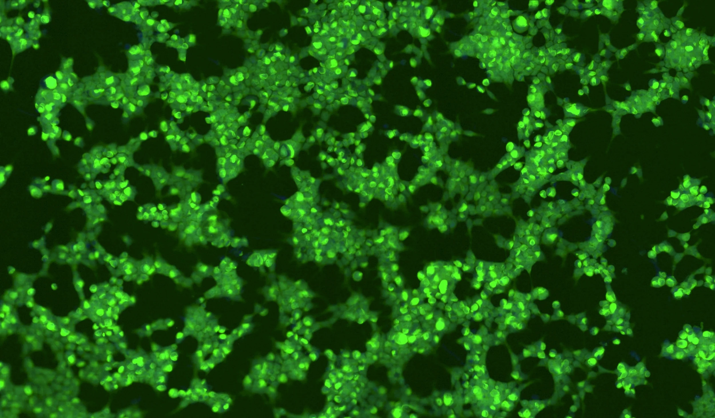     The Kotzbauer lab at Washington University School of Medicine works to advance understanding of neurodegenerative disorders and to translate this knowledge into new treatments.   Learn More  