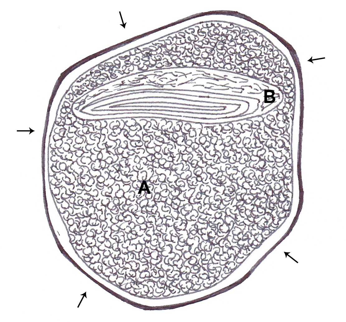 Kotzbauer Chapter 61 Figure New.jpg