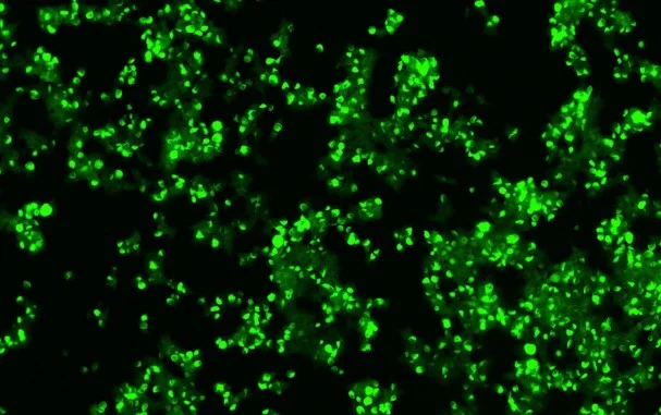 MSA Caudate seeded fibrils case 1.jpg