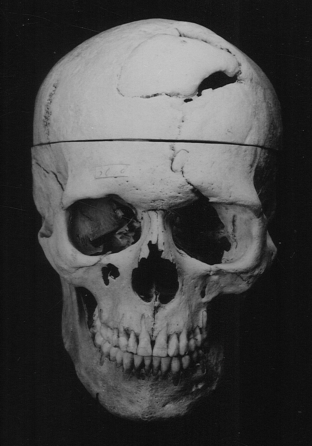 Gage.Skull_frontview.jpg