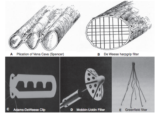 Early-IVC-filters.jpg