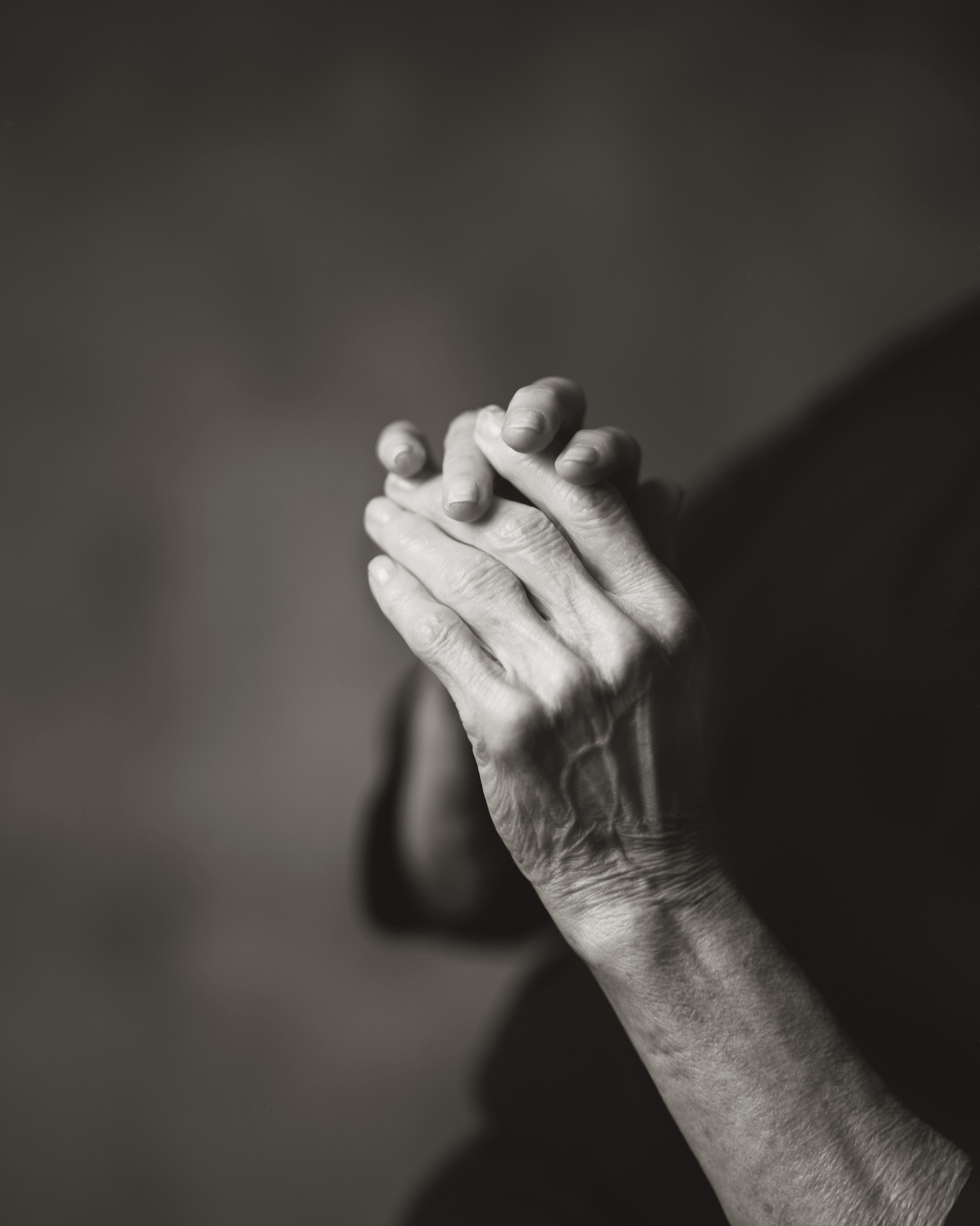  MY MOTHER’S HANDS, WITH ARTHRITIS, 2015 