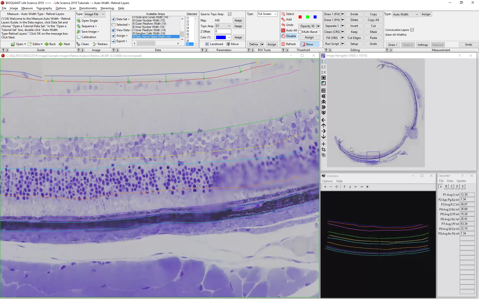 Retinal Layer Thickness