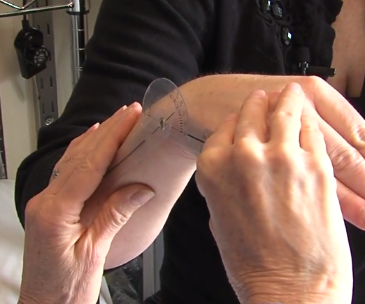 Radial Fracture, Part 3: Measuring Range of Motion, ICE Video Library
