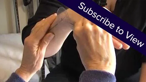 Radial Fracture, Part 3: Measuring ROM ( click here for sample videos )