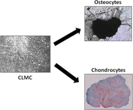 CLMC Differentiated into Bone and Cartilage cells