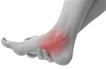 Foot Ankle Sprain Broken AAA Physical Therapy.jpg