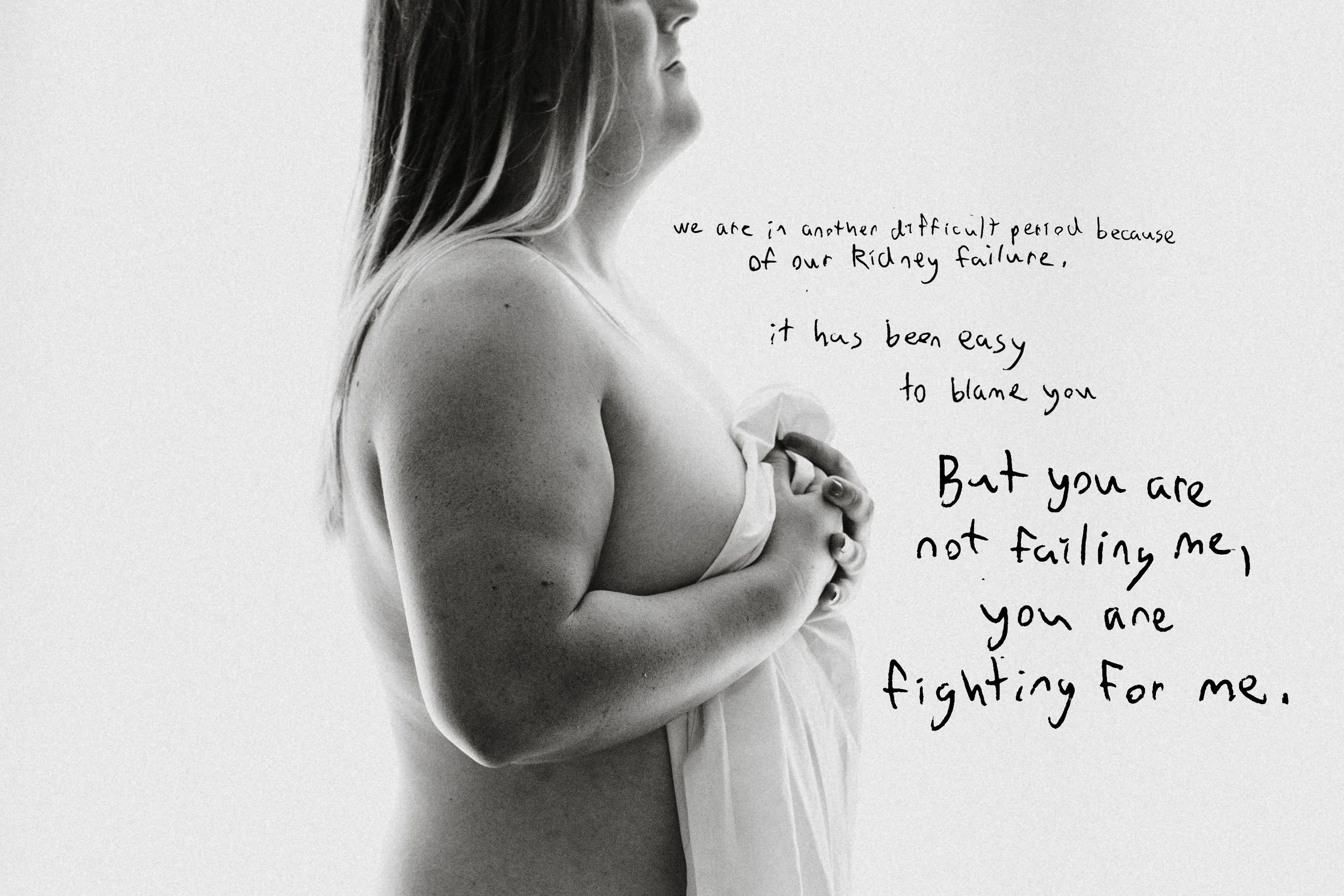 Bree's boudoir story: Cultivating self-love as a trans woman awaiting a kidney transplant