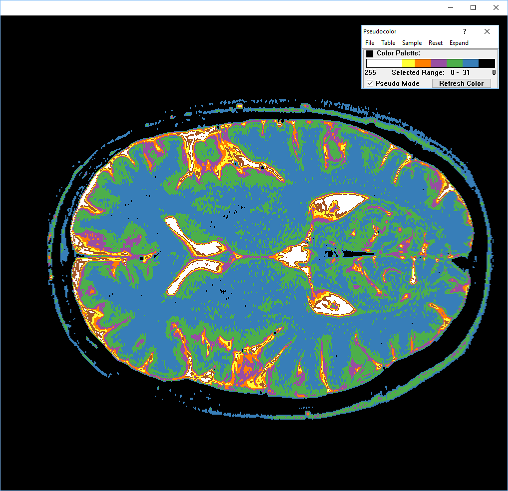 pseudocolor-mri.png
