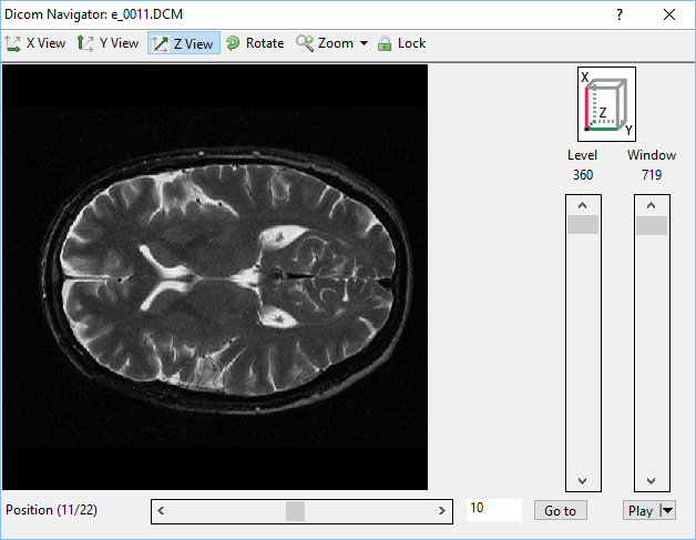 dicom-navigator.png