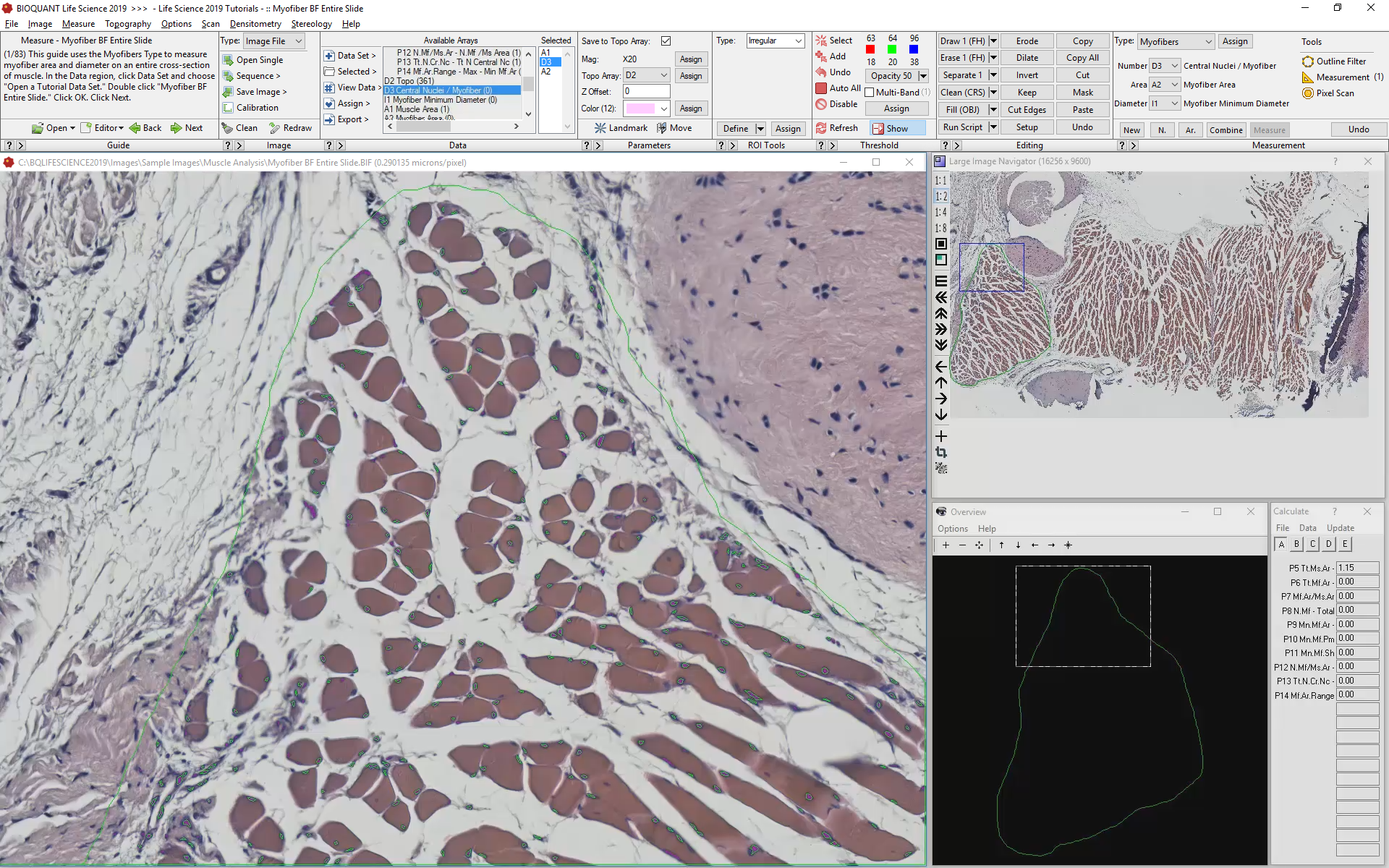 Zoom in to Identify Myofibers