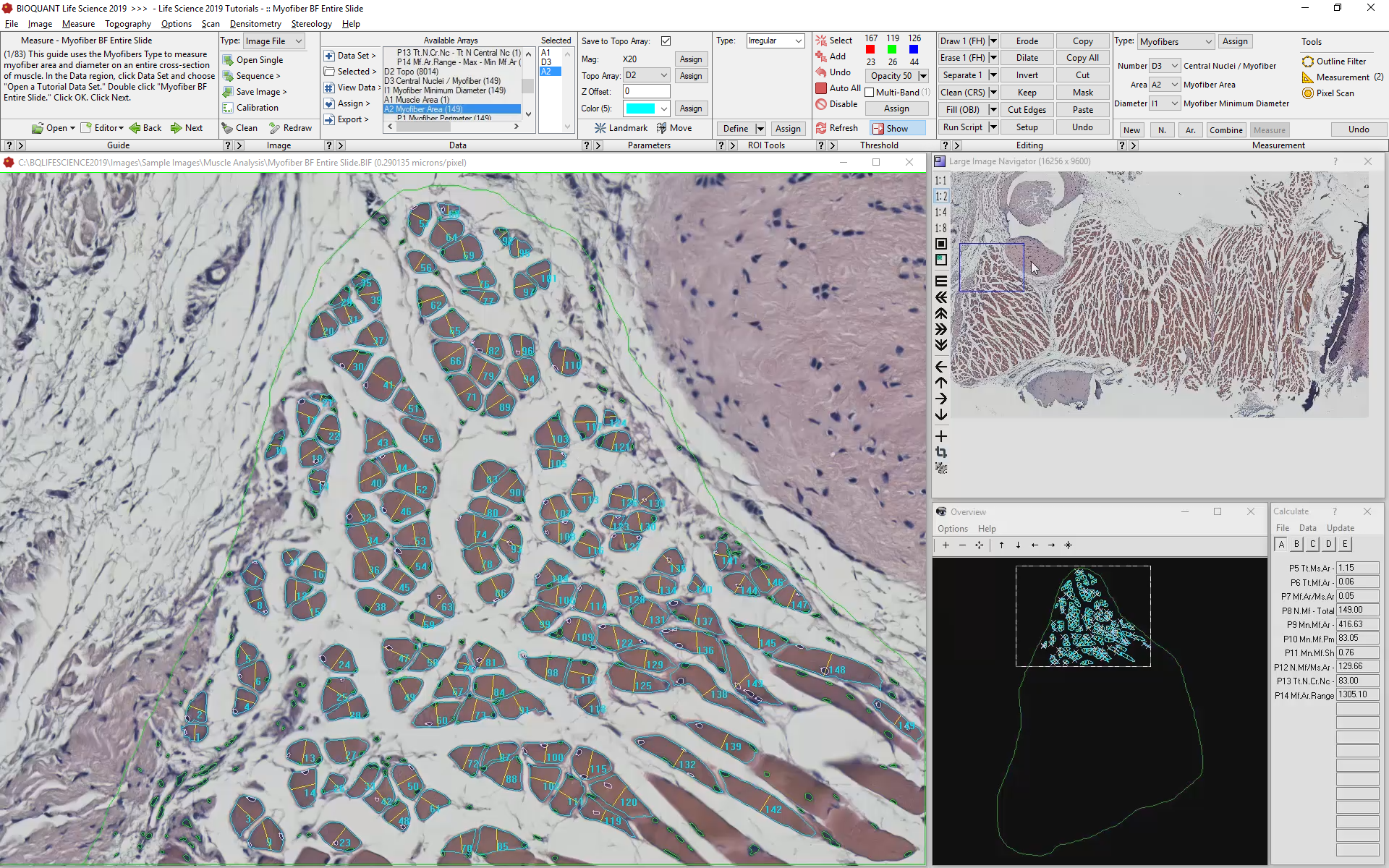 Analyze Myofibers and Associated Nuclei