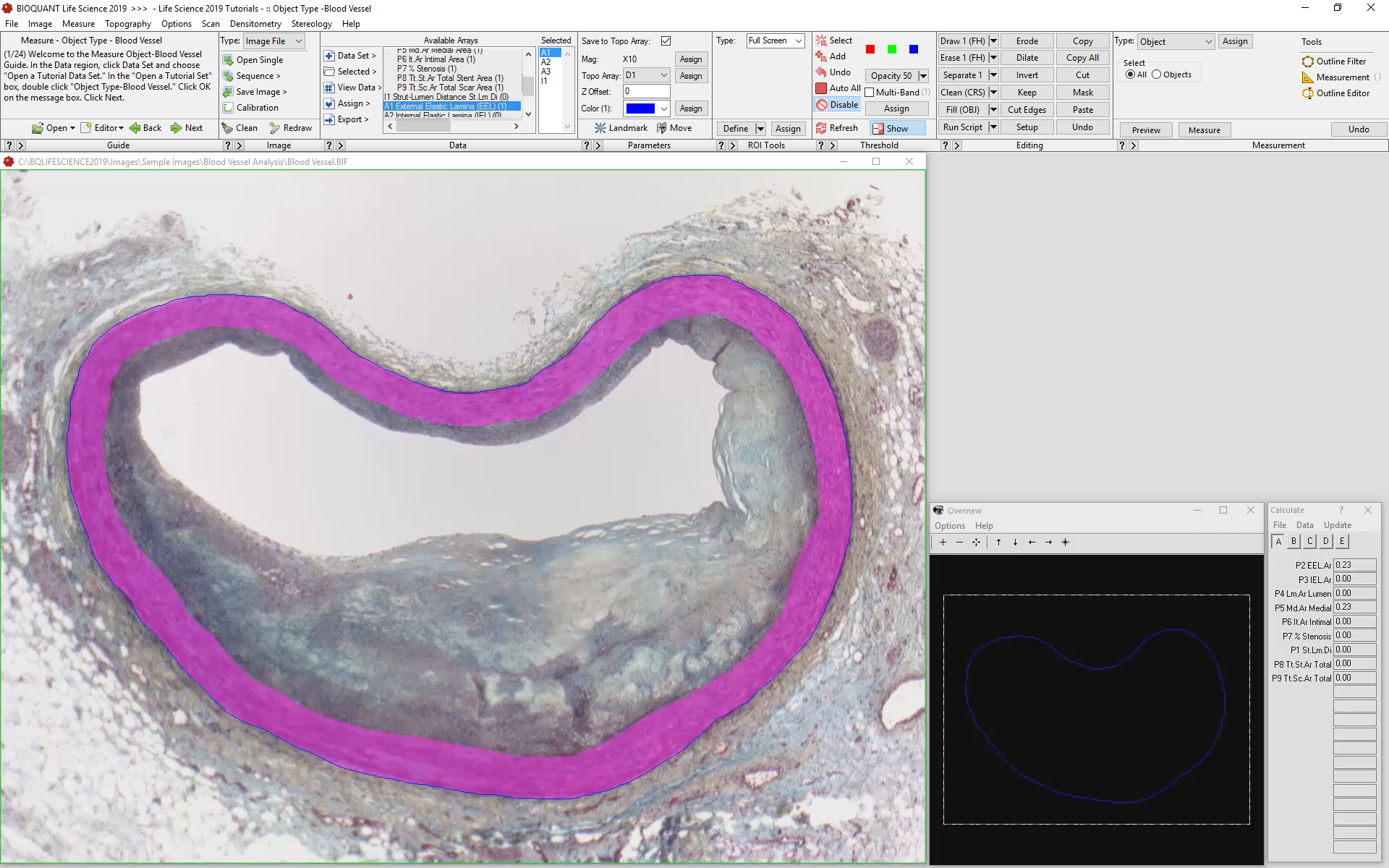 Blood Vessel Analysis