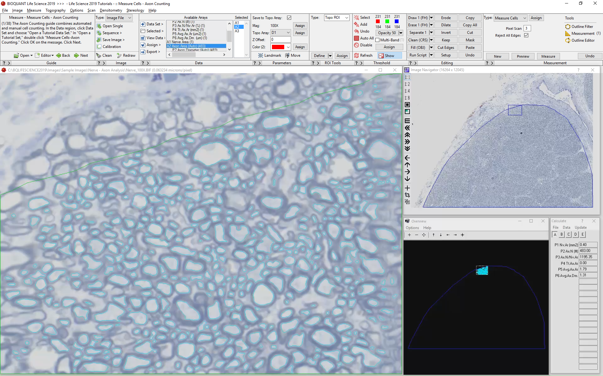 Axon Analysis in Nerve Cross-section