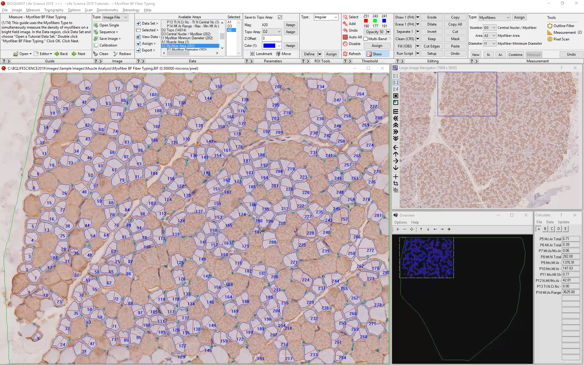 Myofiber_bf_fibertyping-measured.png