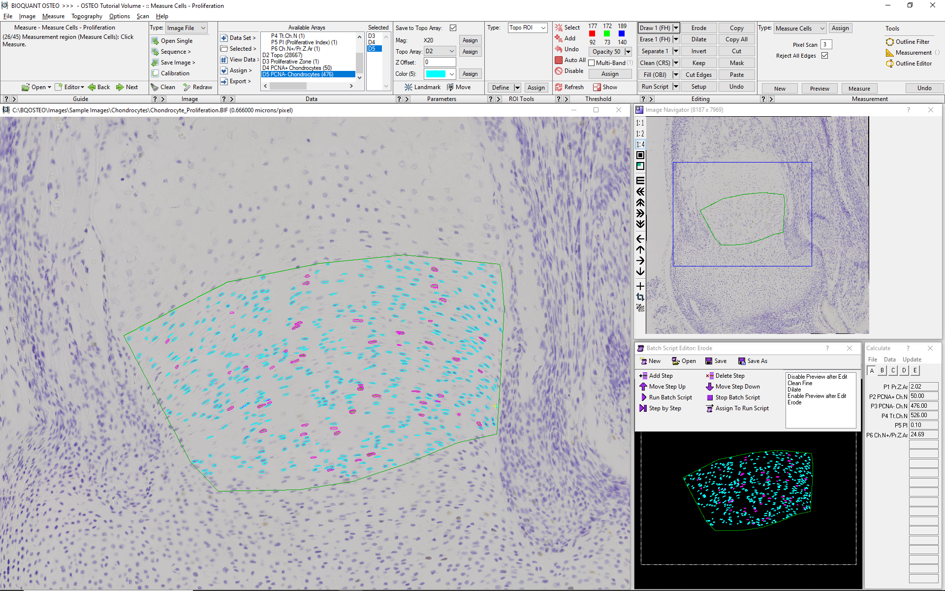 Chondrocyte Proliferation