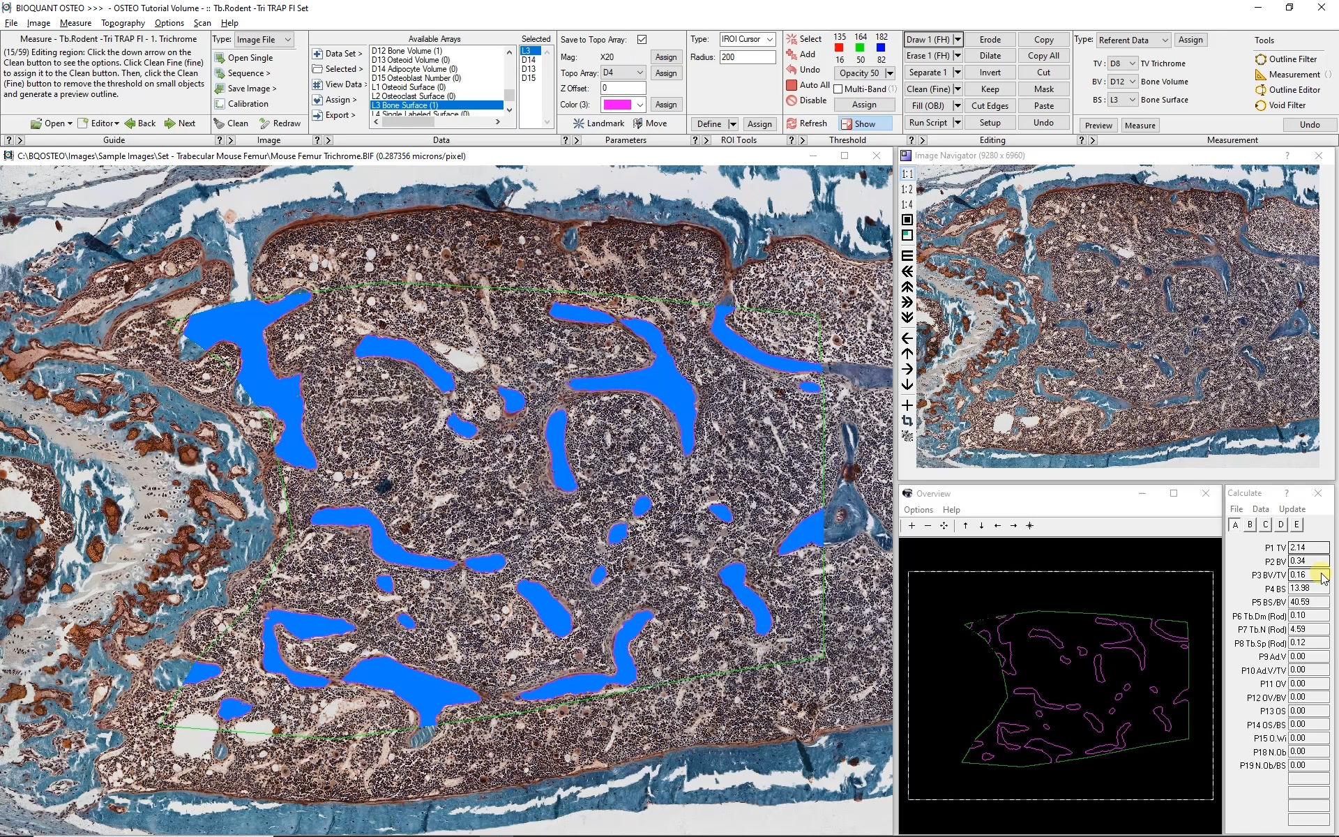 Faster Skeletal Phenotyping